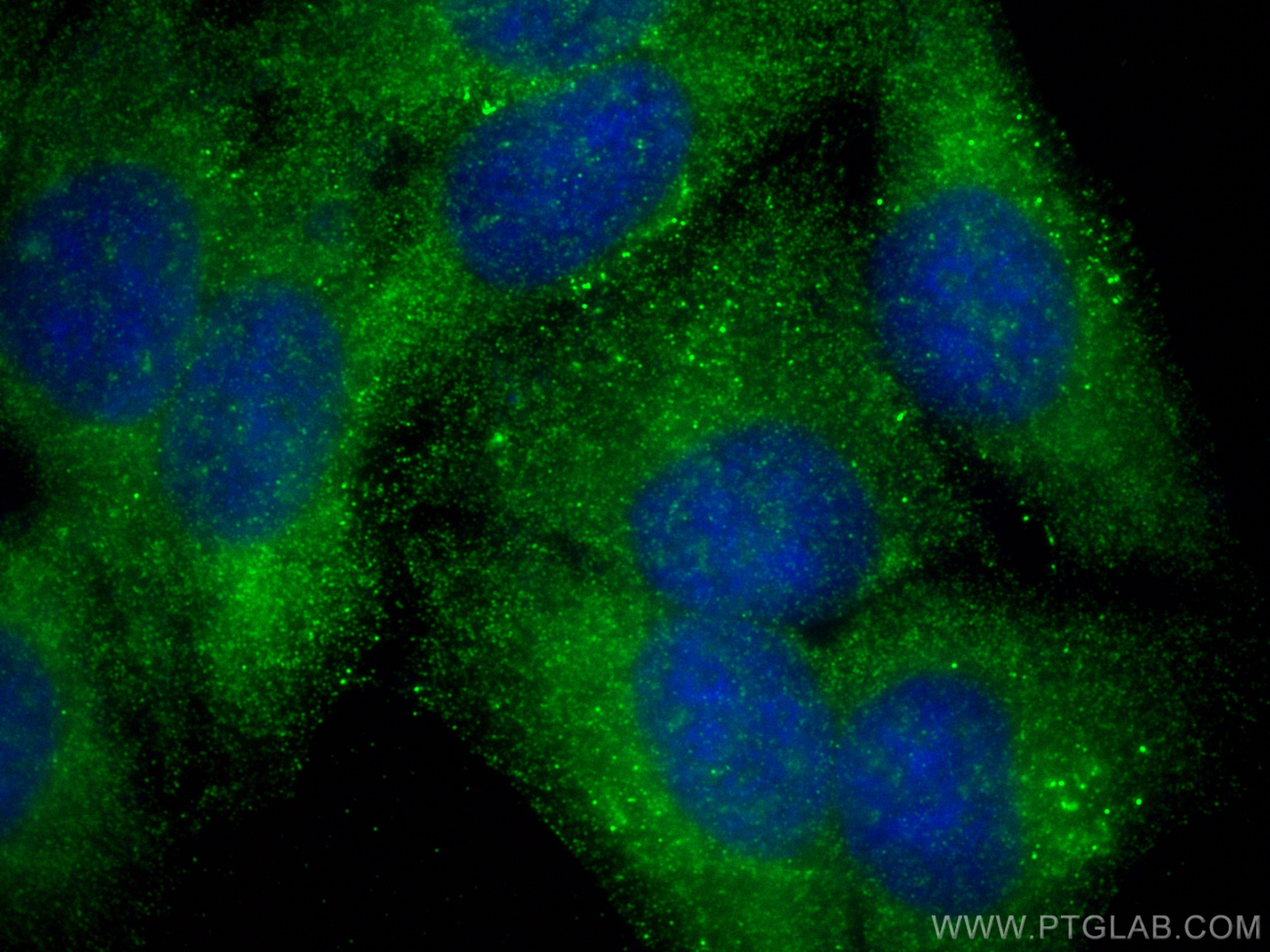 Immunofluorescence (IF) / fluorescent staining of HepG2 cells using CYP8B1 Polyclonal antibody (55217-1-AP)