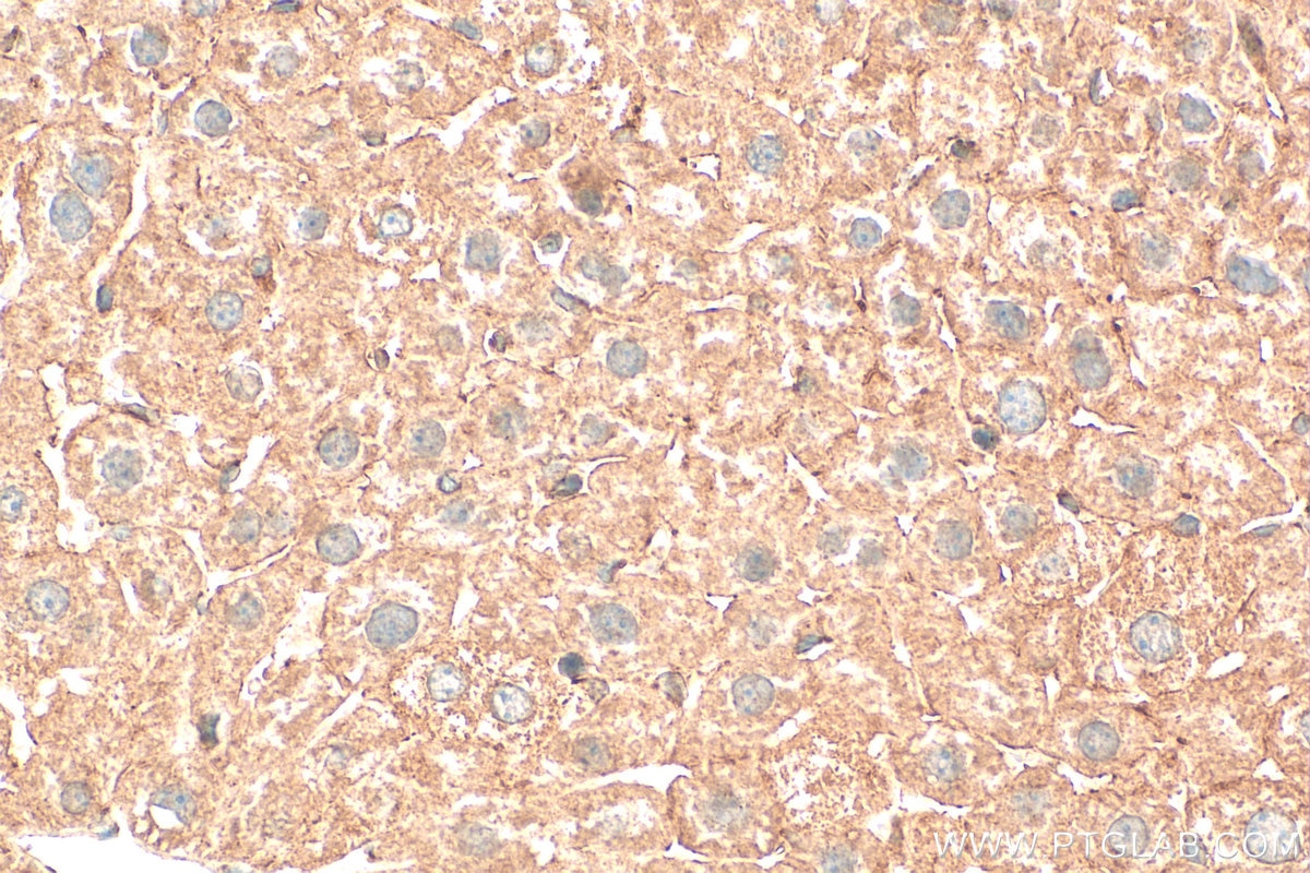 Immunohistochemistry (IHC) staining of mouse liver tissue using CYP8B1 Polyclonal antibody (55217-1-AP)