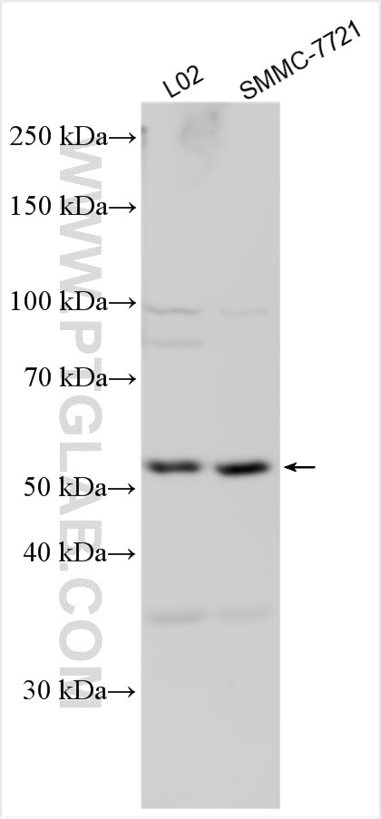 Western Blot (WB) analysis of various lysates using CYP8B1 Polyclonal antibody (55217-1-AP)