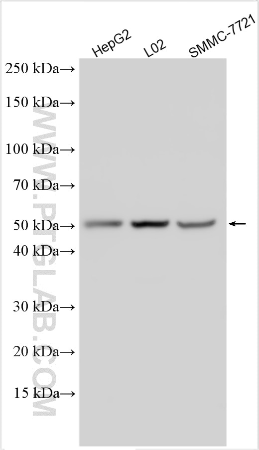 Western Blot (WB) analysis of various lysates using CYP8B1 Polyclonal antibody (55217-1-AP)