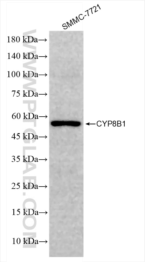 Western Blot (WB) analysis of SMMC-7721 cells using CYP8B1 Recombinant antibody (84909-1-RR)