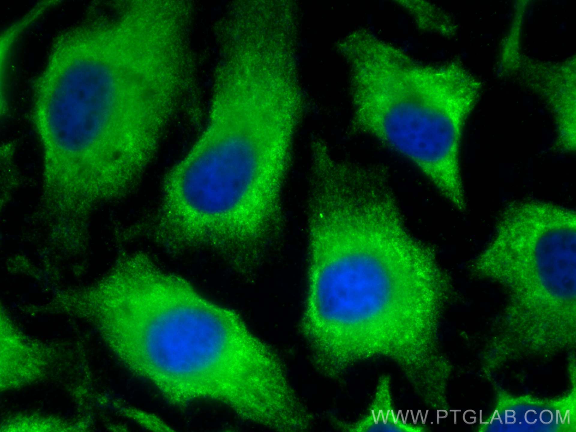 Immunofluorescence (IF) / fluorescent staining of HeLa cells using Cyclophilin A Monoclonal antibody (67880-1-Ig)