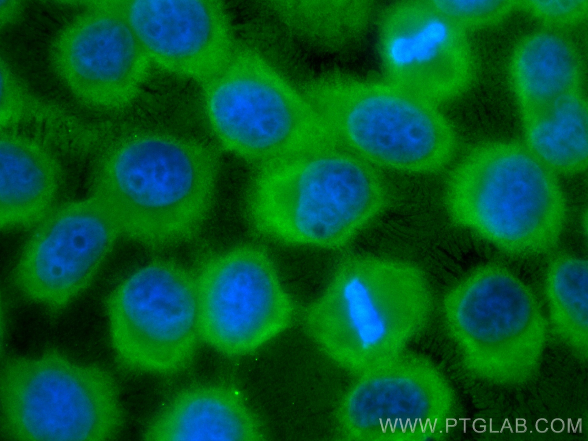 Immunofluorescence (IF) / fluorescent staining of A431 cells using CYR61 Monoclonal antibody (67656-1-Ig)