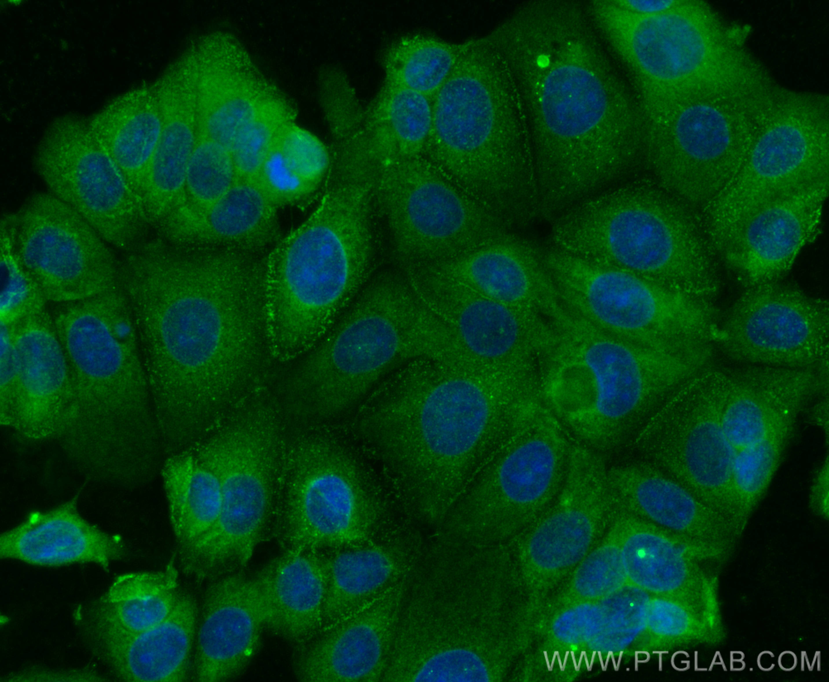 Immunofluorescence (IF) / fluorescent staining of MCF-7 cells using CYR61 Monoclonal antibody (67656-1-Ig)