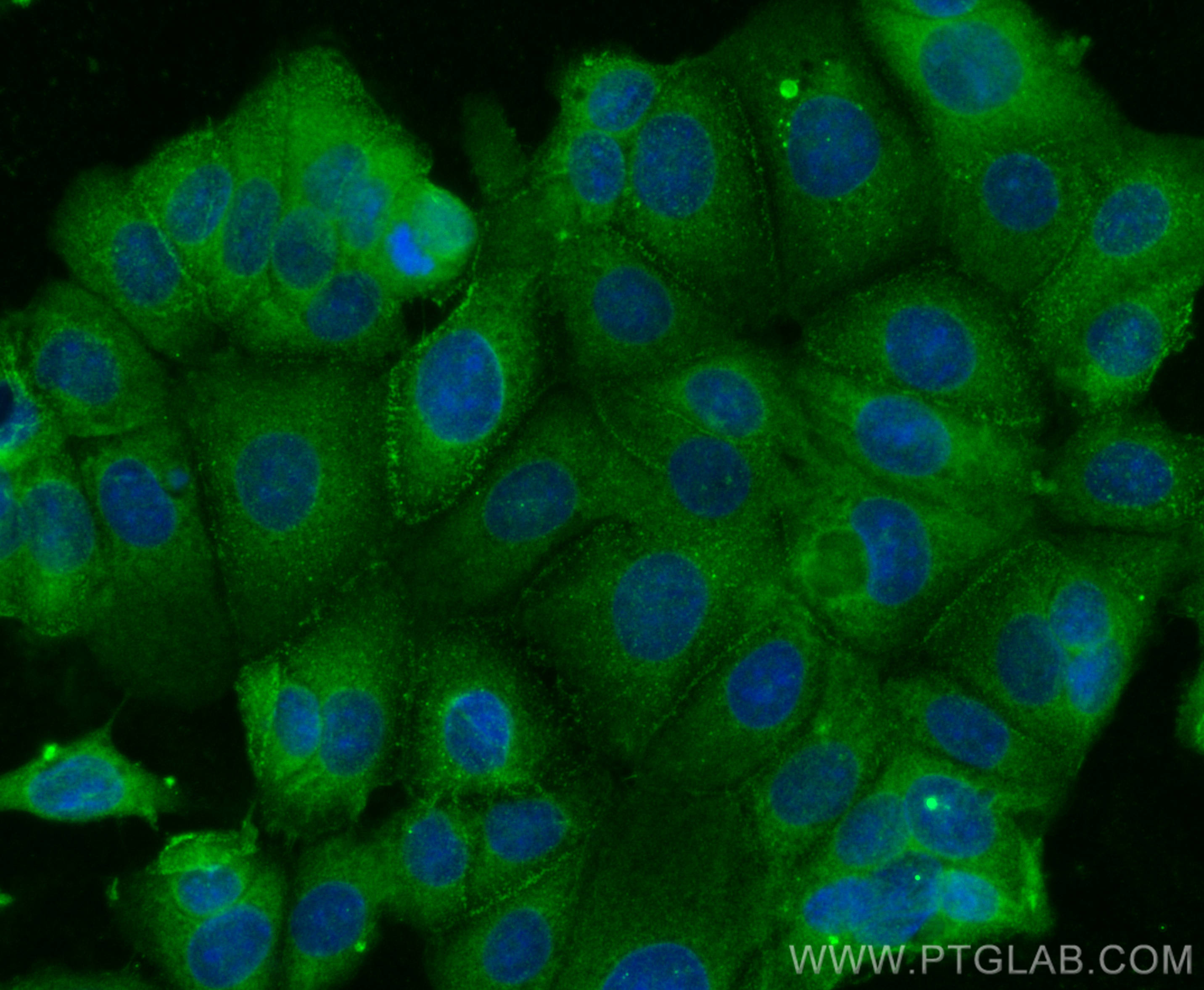 IF Staining of MCF-7 using 67656-1-Ig