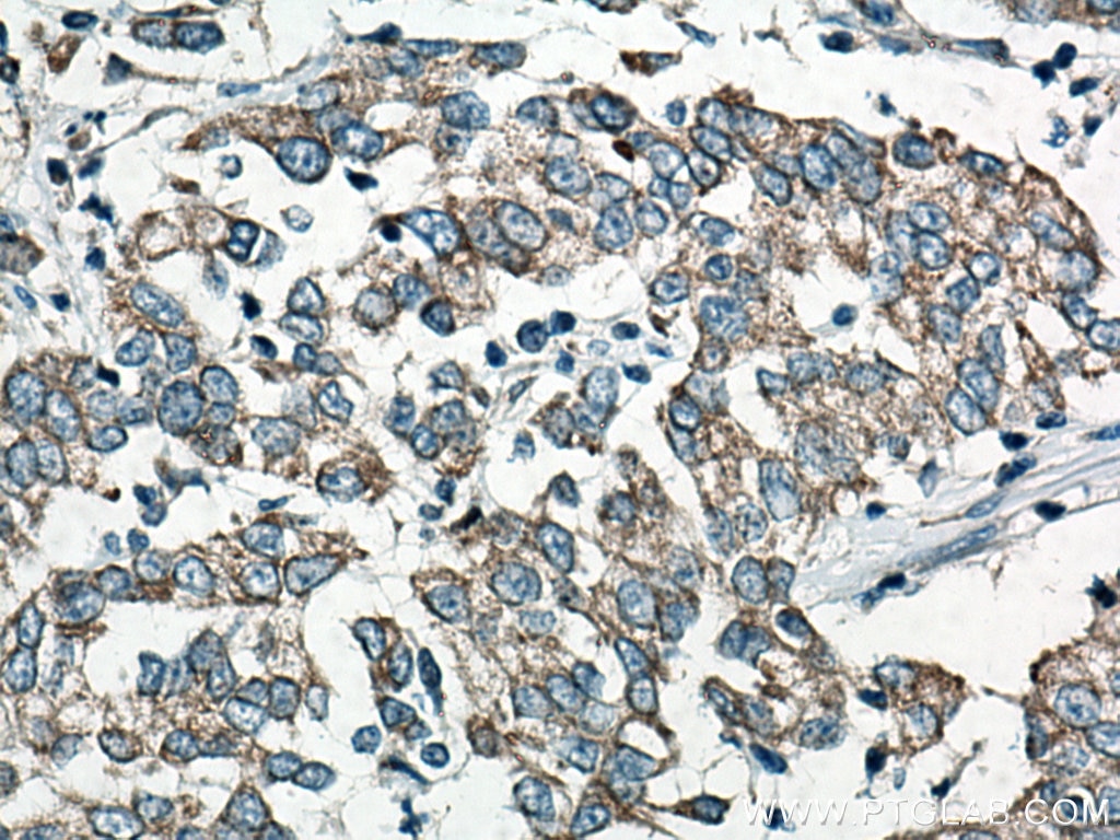 CYR61/CCN1