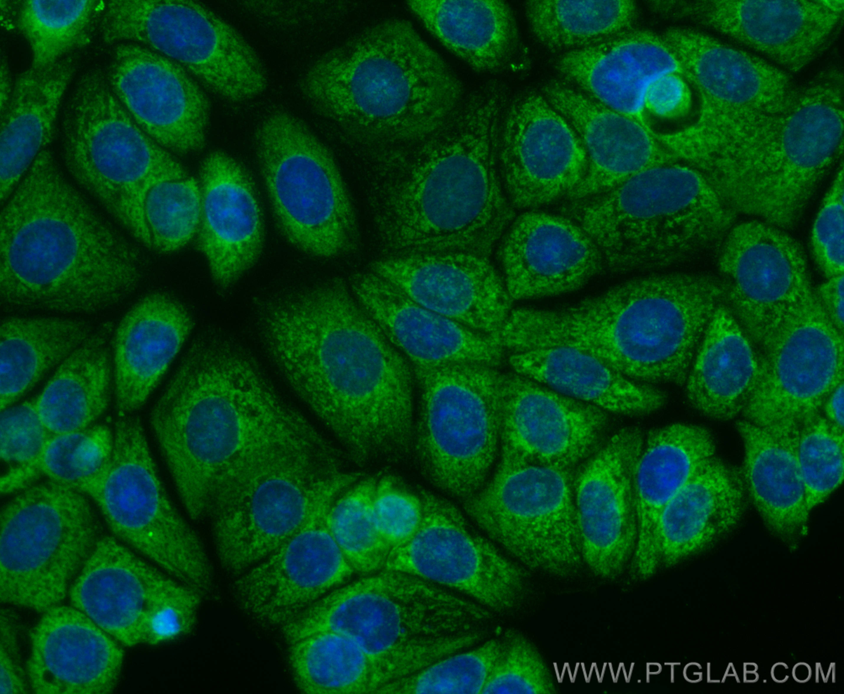 Immunofluorescence (IF) / fluorescent staining of MCF-7 cells using CoraLite® Plus 488-conjugated CYR61 Monoclonal ant (CL488-67656)