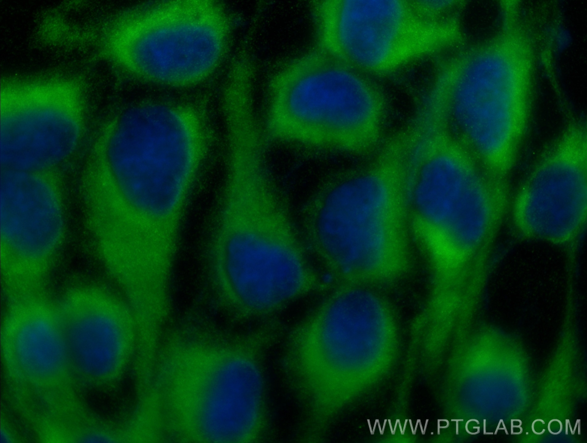 Immunofluorescence (IF) / fluorescent staining of A431 cells using CYR61/CCN1 Polyclonal antibody (26689-1-AP)