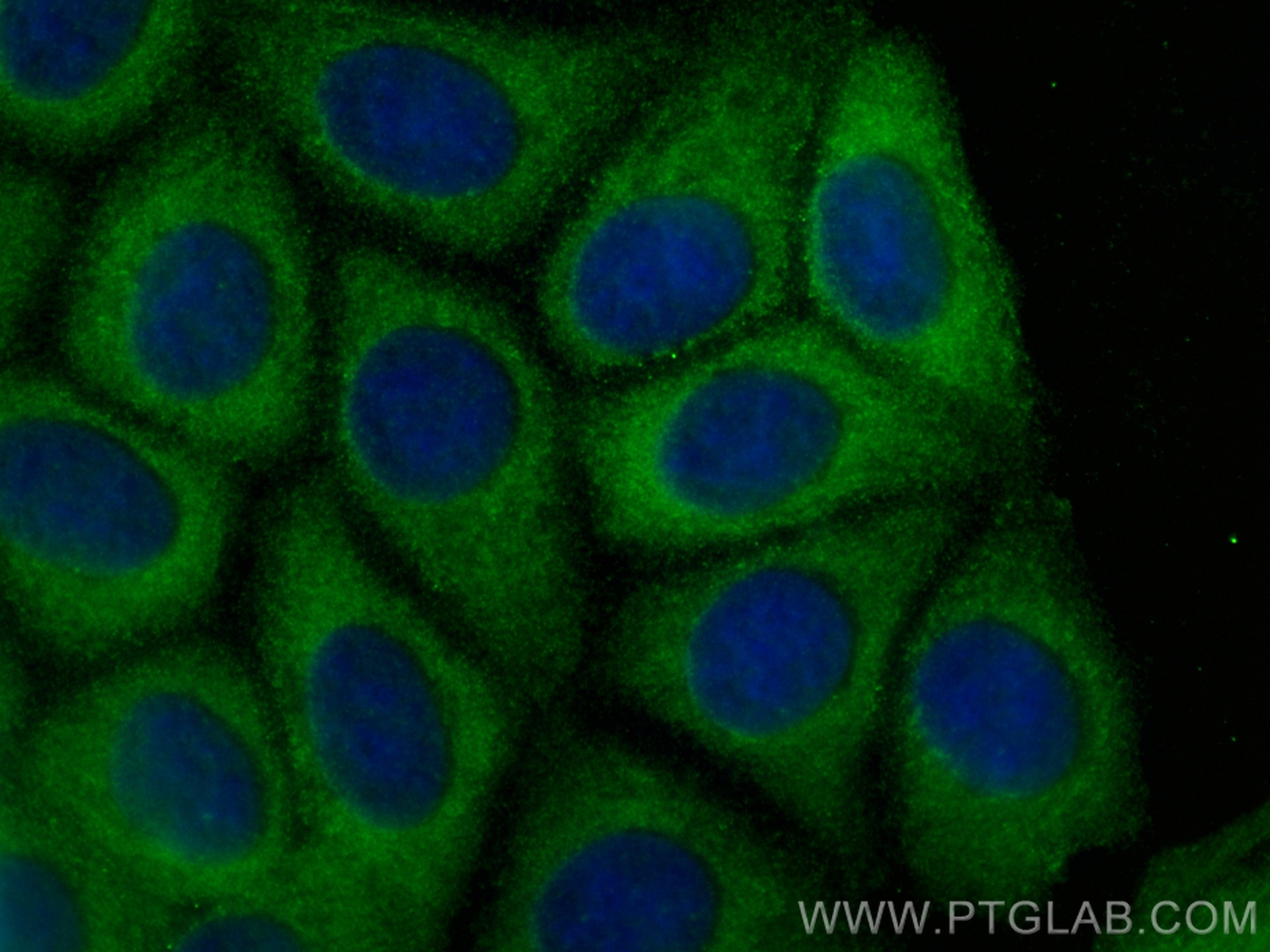 Immunofluorescence (IF) / fluorescent staining of MCF-7 cells using CYR61/CCN1 Polyclonal antibody (26689-1-AP)