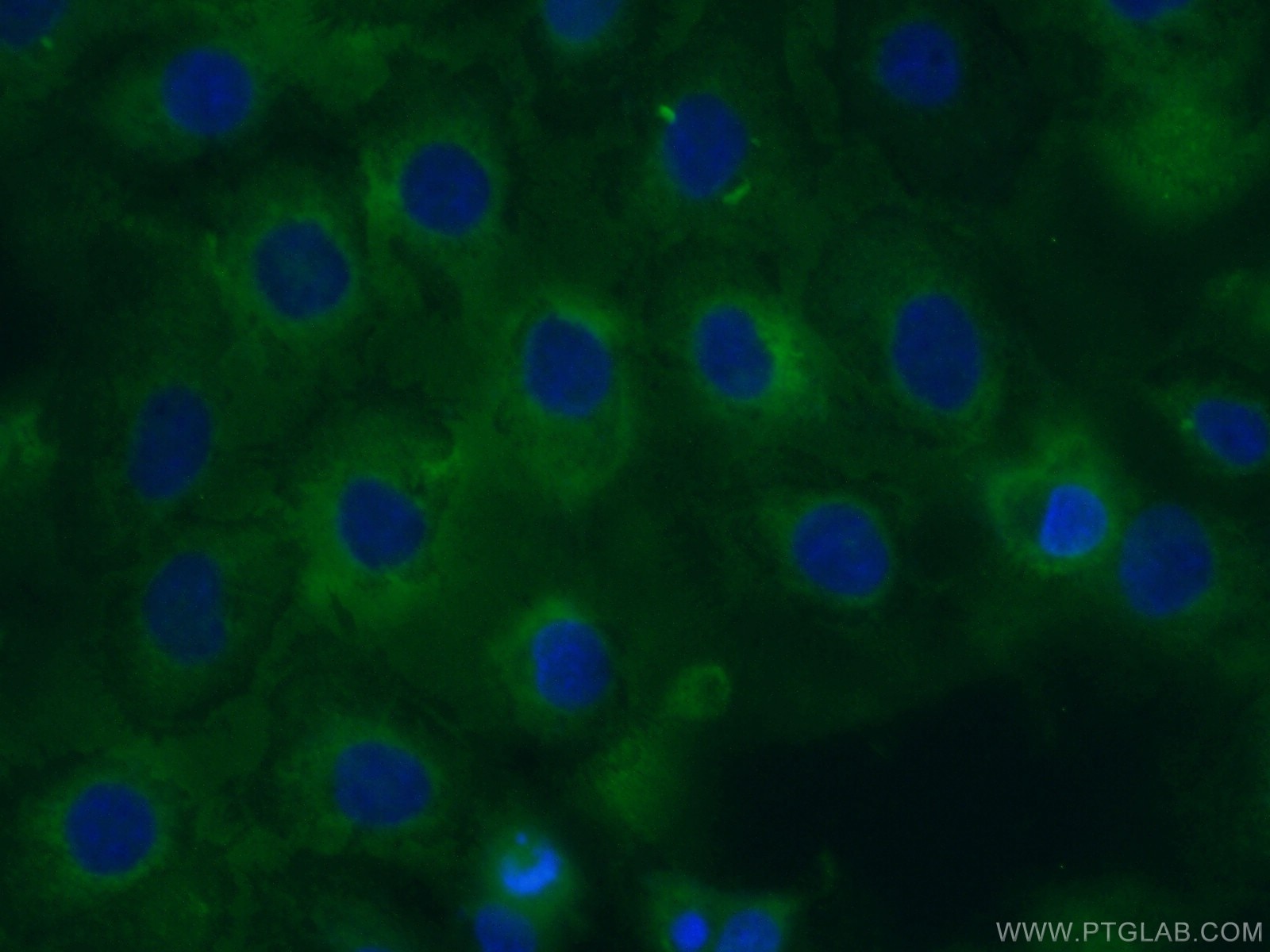 Immunofluorescence (IF) / fluorescent staining of A431 cells using CYR61/CCN1 Polyclonal antibody (26689-1-AP)