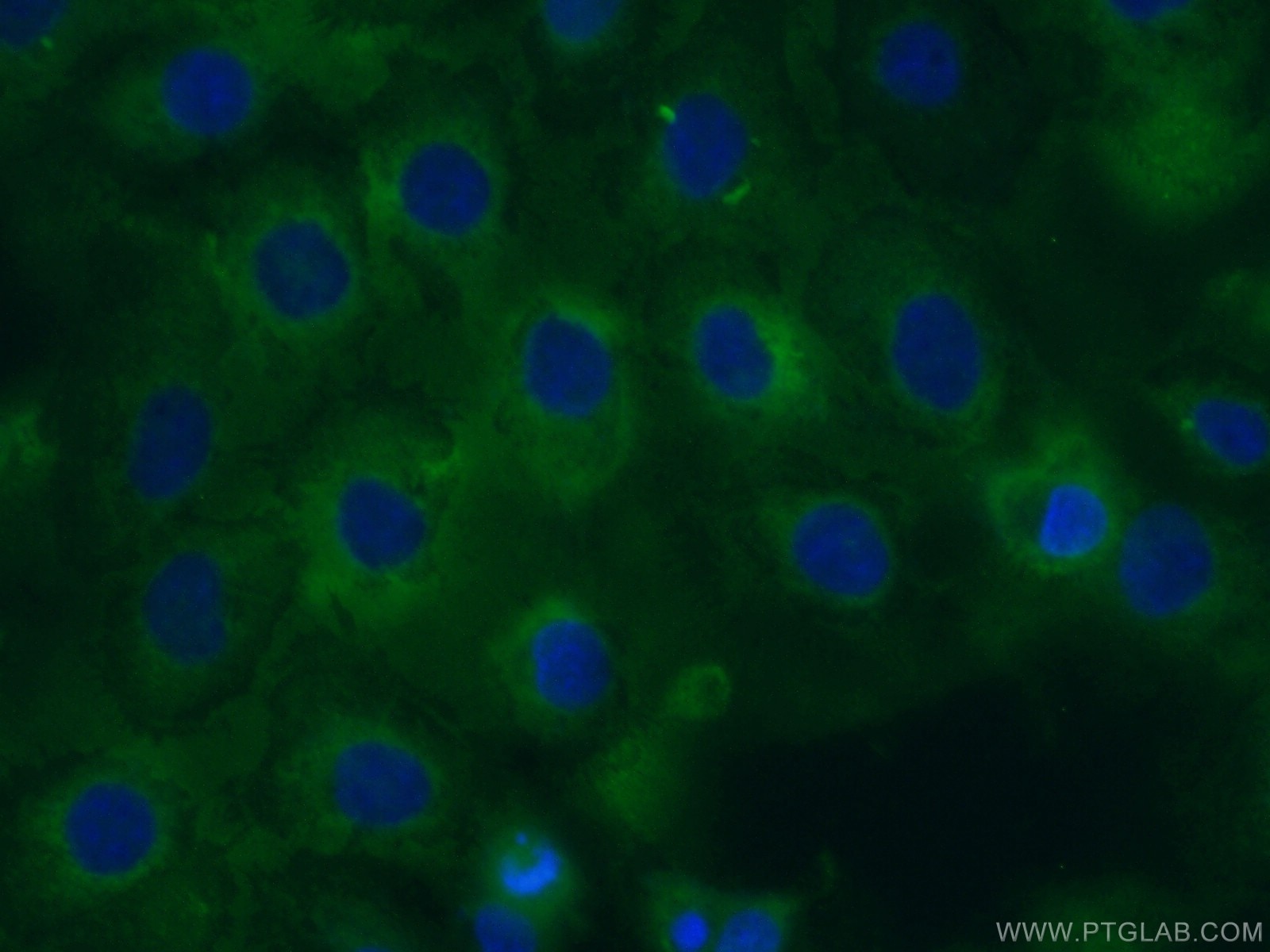 IF Staining of A431 using 26689-1-AP