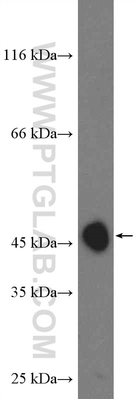 CYR61/CCN1 Polyclonal antibody