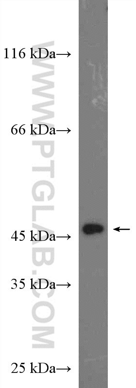 Western Blot (WB) analysis of MDA-MB-453s cells using CYR61/CCN1 Polyclonal antibody (26689-1-AP)