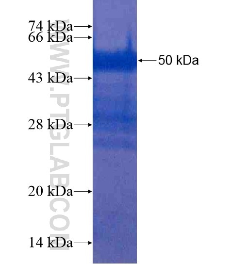 CYS1 fusion protein Ag19743 SDS-PAGE