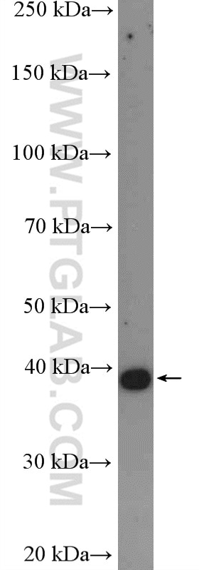 Western Blot (WB) analysis of mouse heart tissue using CYSLTR1 Polyclonal antibody (27372-1-AP)