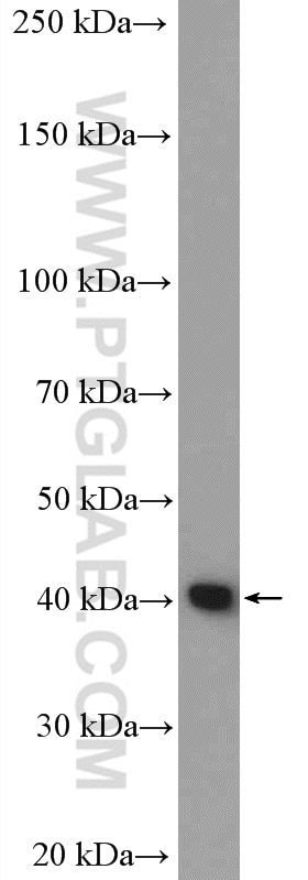 Western Blot (WB) analysis of rat heart tissue using CYSLTR1 Polyclonal antibody (27372-1-AP)