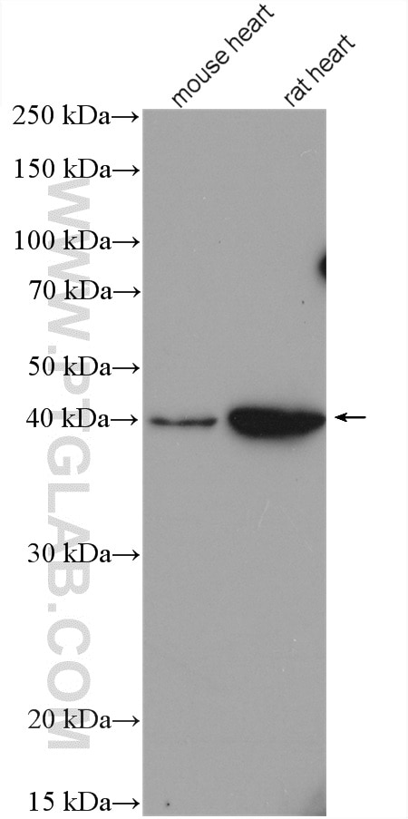 Western Blot (WB) analysis of various lysates using CYSLTR1 Polyclonal antibody (27372-1-AP)