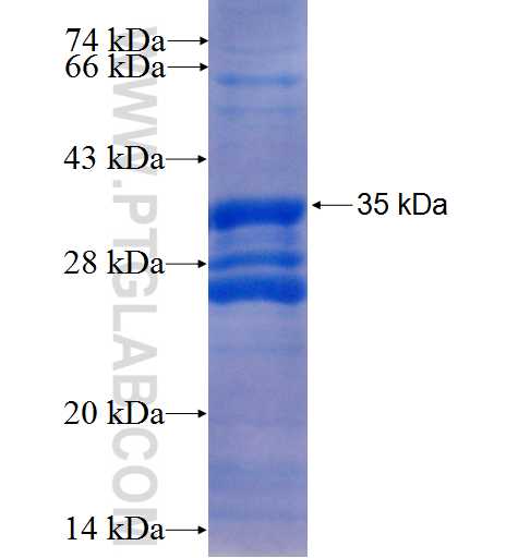 CYSLTR1 fusion protein Ag24961 SDS-PAGE
