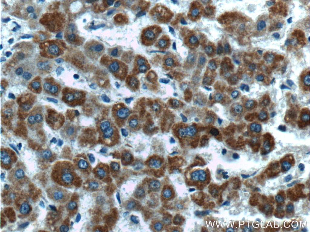 CYTB Polyclonal antibody