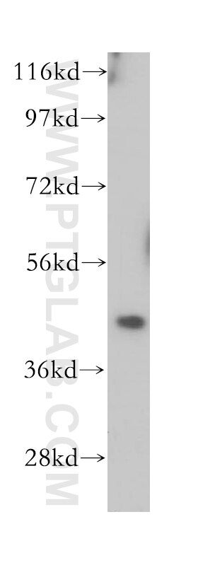 Cytohesin 1