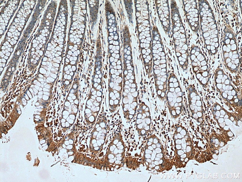 IHC staining of human colon using 10405-1-AP