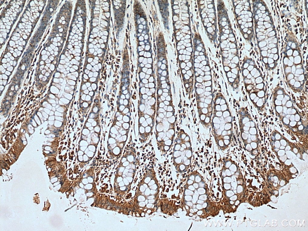 Immunohistochemistry (IHC) staining of human colon tissue using Cytohesin 2 Polyclonal antibody (10405-1-AP)