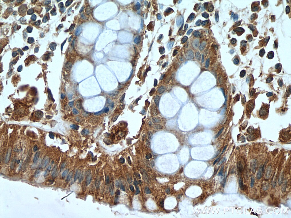 Immunohistochemistry (IHC) staining of human colon tissue using Cytohesin 2 Polyclonal antibody (10405-1-AP)