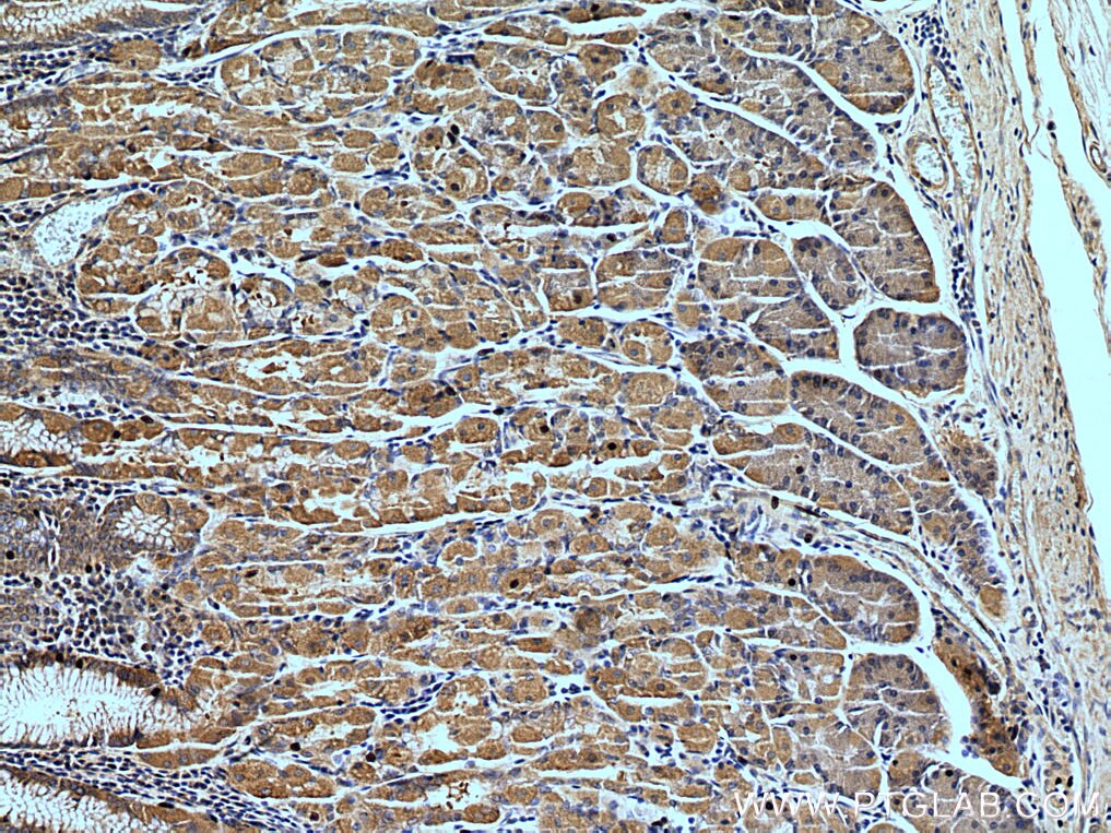 Immunohistochemistry (IHC) staining of human stomach tissue using Cytohesin 2 Polyclonal antibody (10405-1-AP)