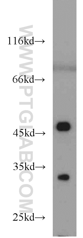 Western Blot (WB) analysis of mouse heart tissue using Cytohesin 2 Polyclonal antibody (10405-1-AP)