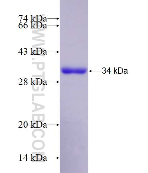 CYTH2 fusion protein Ag21279 SDS-PAGE