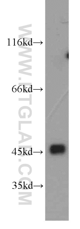 Western Blot (WB) analysis of human brain tissue using Cytohesin 3 Polyclonal antibody (16687-1-AP)