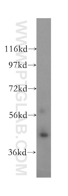 Western Blot (WB) analysis of human brain tissue using Cytohesin 3 Polyclonal antibody (16687-1-AP)