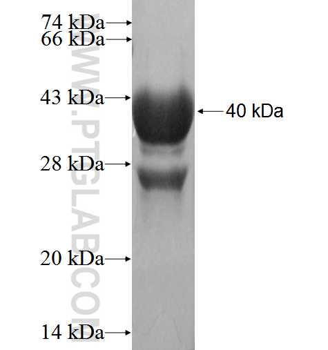 CYTH4 fusion protein Ag2394 SDS-PAGE