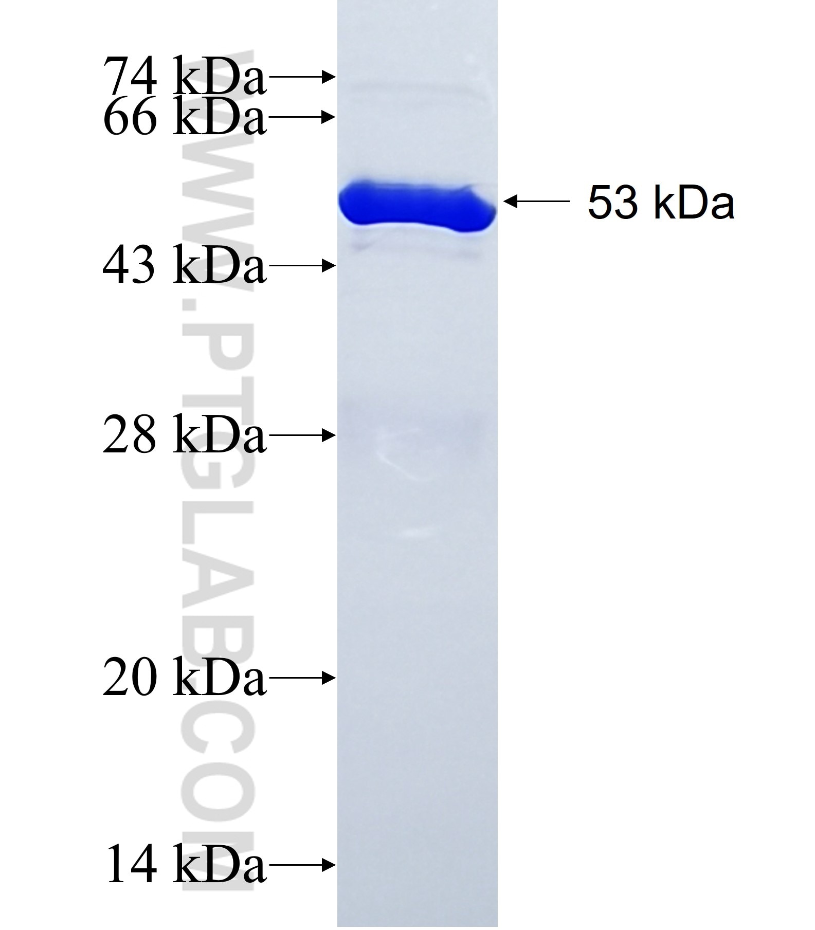 CYTIP fusion protein Ag39917 SDS-PAGE