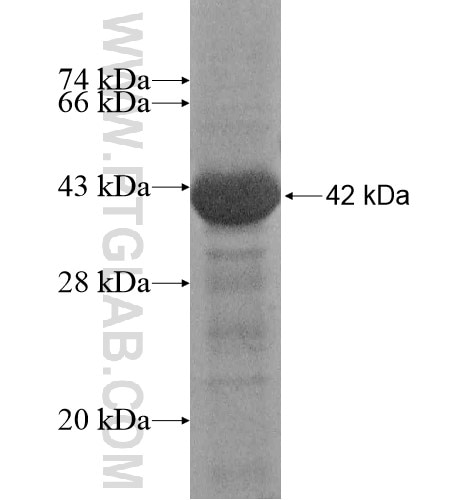 CYTIP fusion protein Ag14495 SDS-PAGE