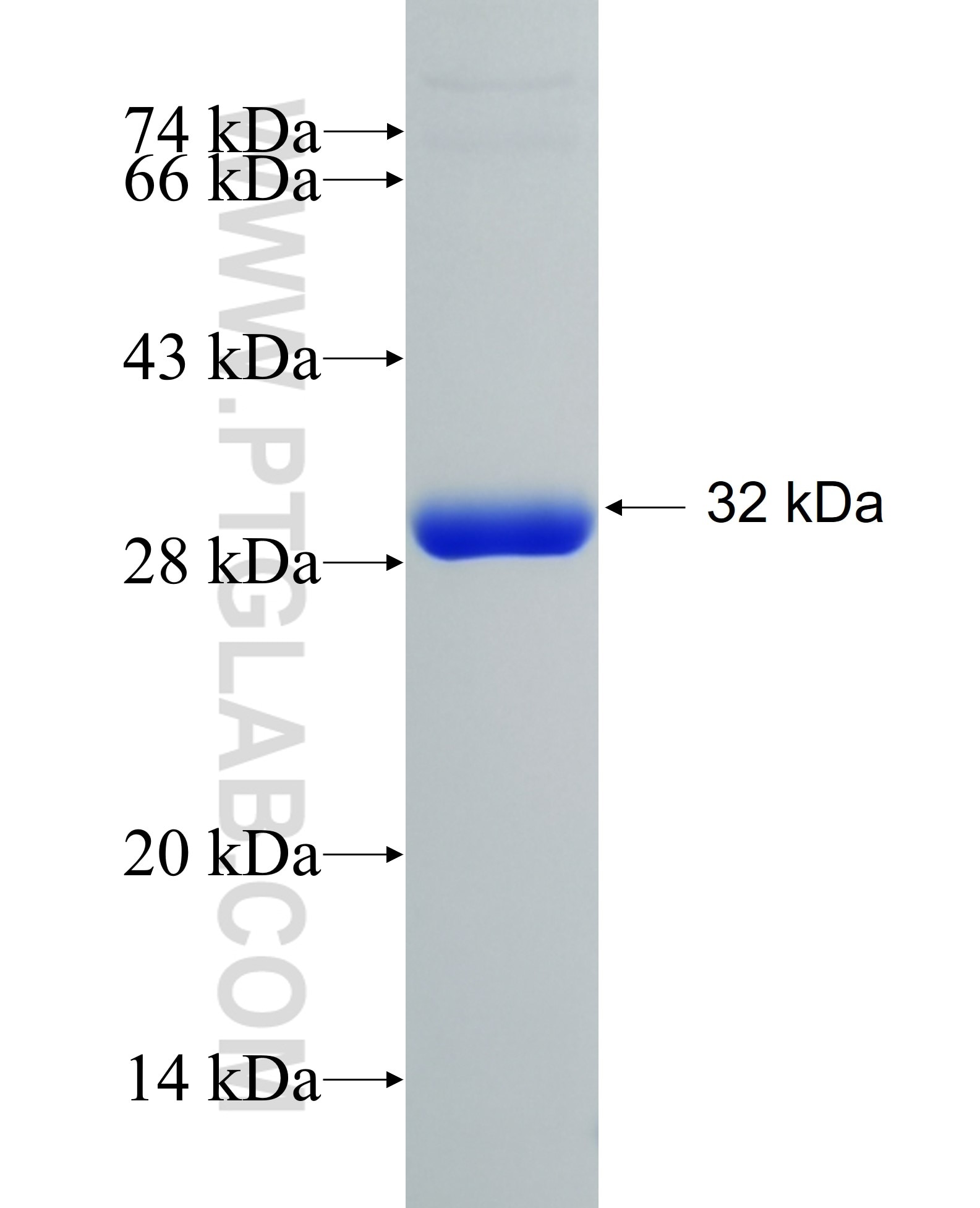 CYTIP fusion protein Ag14495 SDS-PAGE