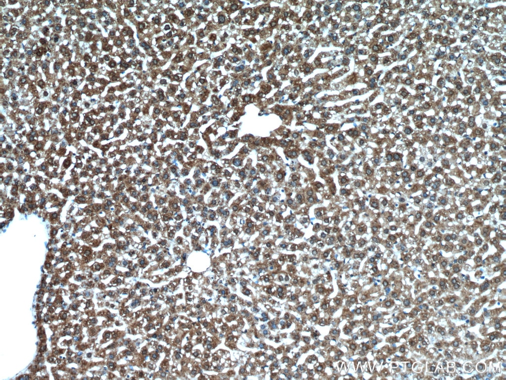 Immunohistochemistry (IHC) staining of mouse liver tissue using CYTL1 Polyclonal antibody (15856-1-AP)