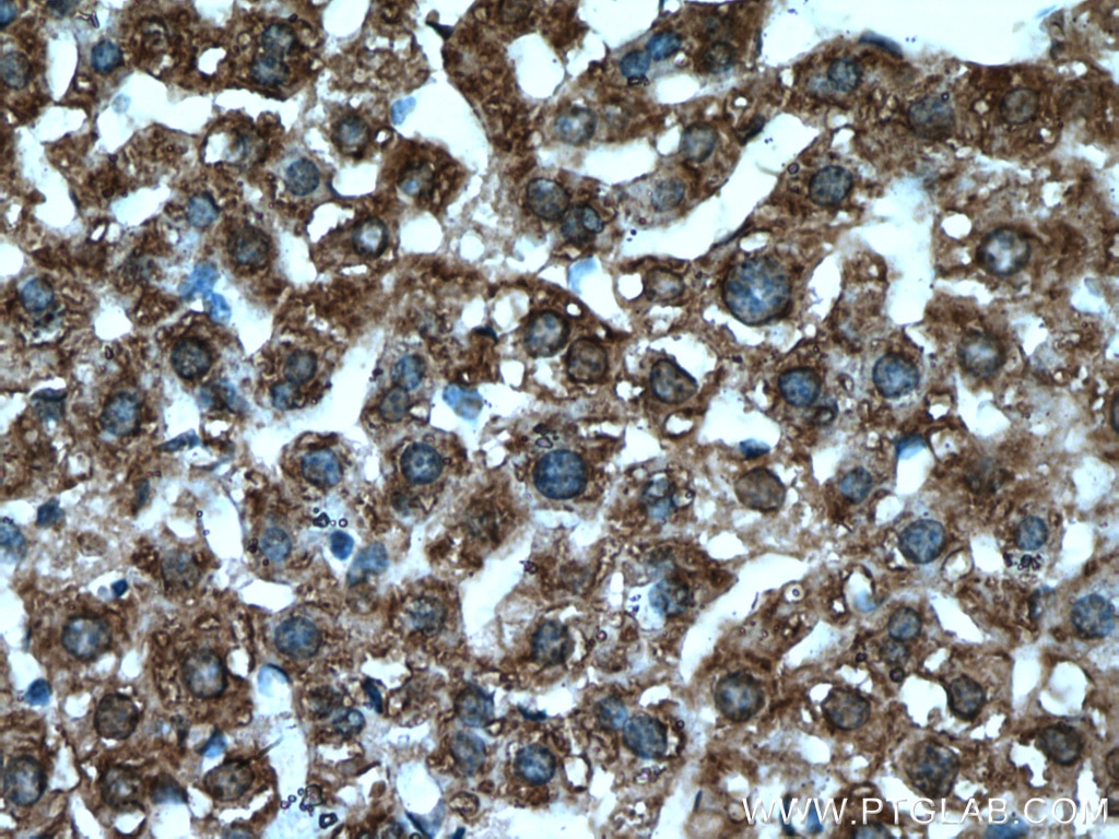 Immunohistochemistry (IHC) staining of mouse liver tissue using CYTL1 Polyclonal antibody (15856-1-AP)