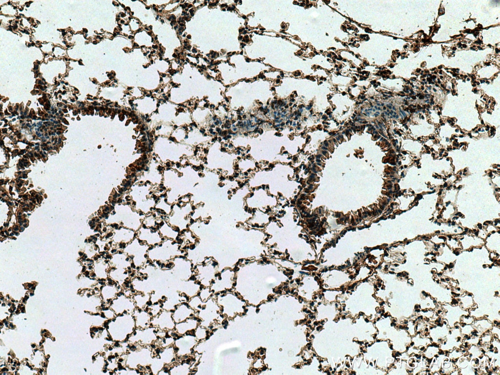 Immunohistochemistry (IHC) staining of mouse lung tissue using CYTL1 Polyclonal antibody (15856-1-AP)
