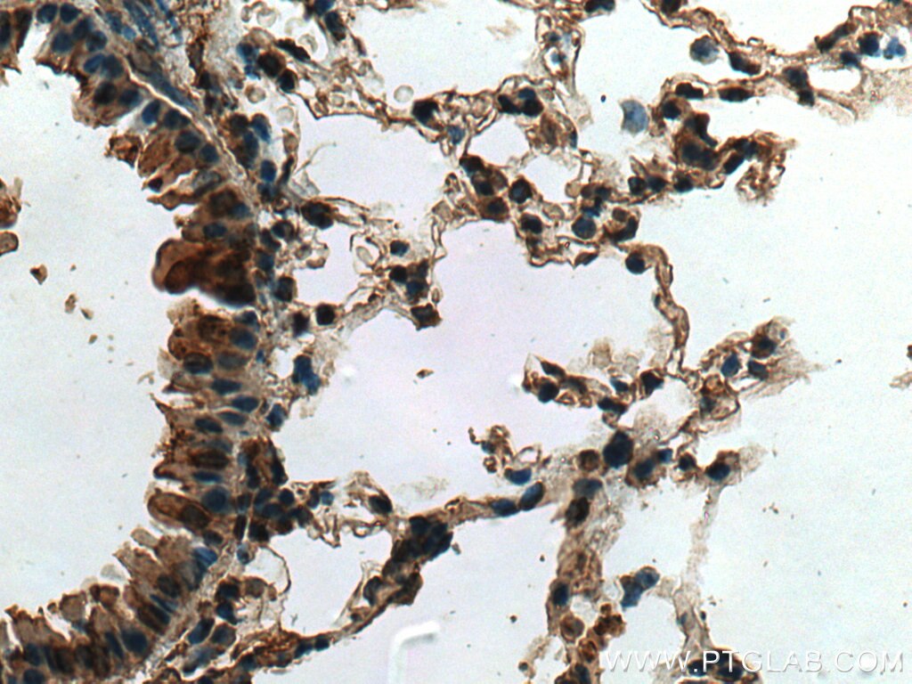 Immunohistochemistry (IHC) staining of mouse lung tissue using CYTL1 Polyclonal antibody (15856-1-AP)