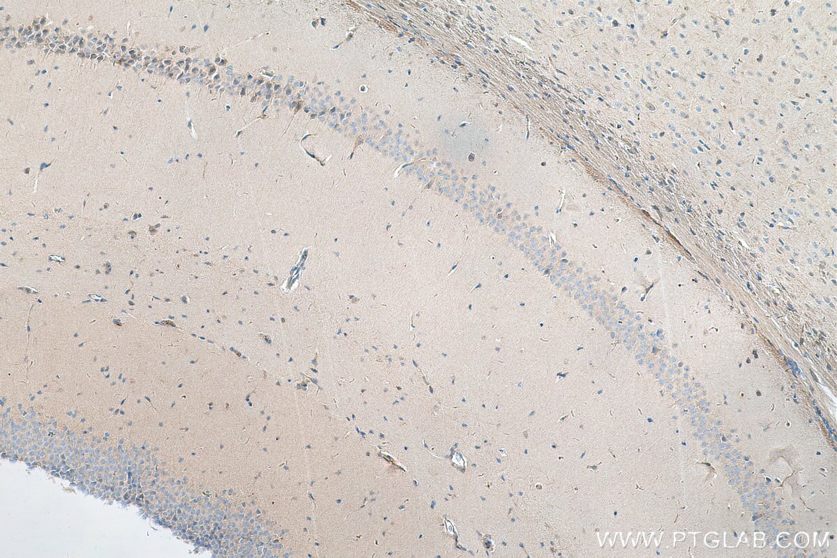 Immunohistochemistry (IHC) staining of mouse brain tissue using CYTSA Polyclonal antibody (25390-1-AP)