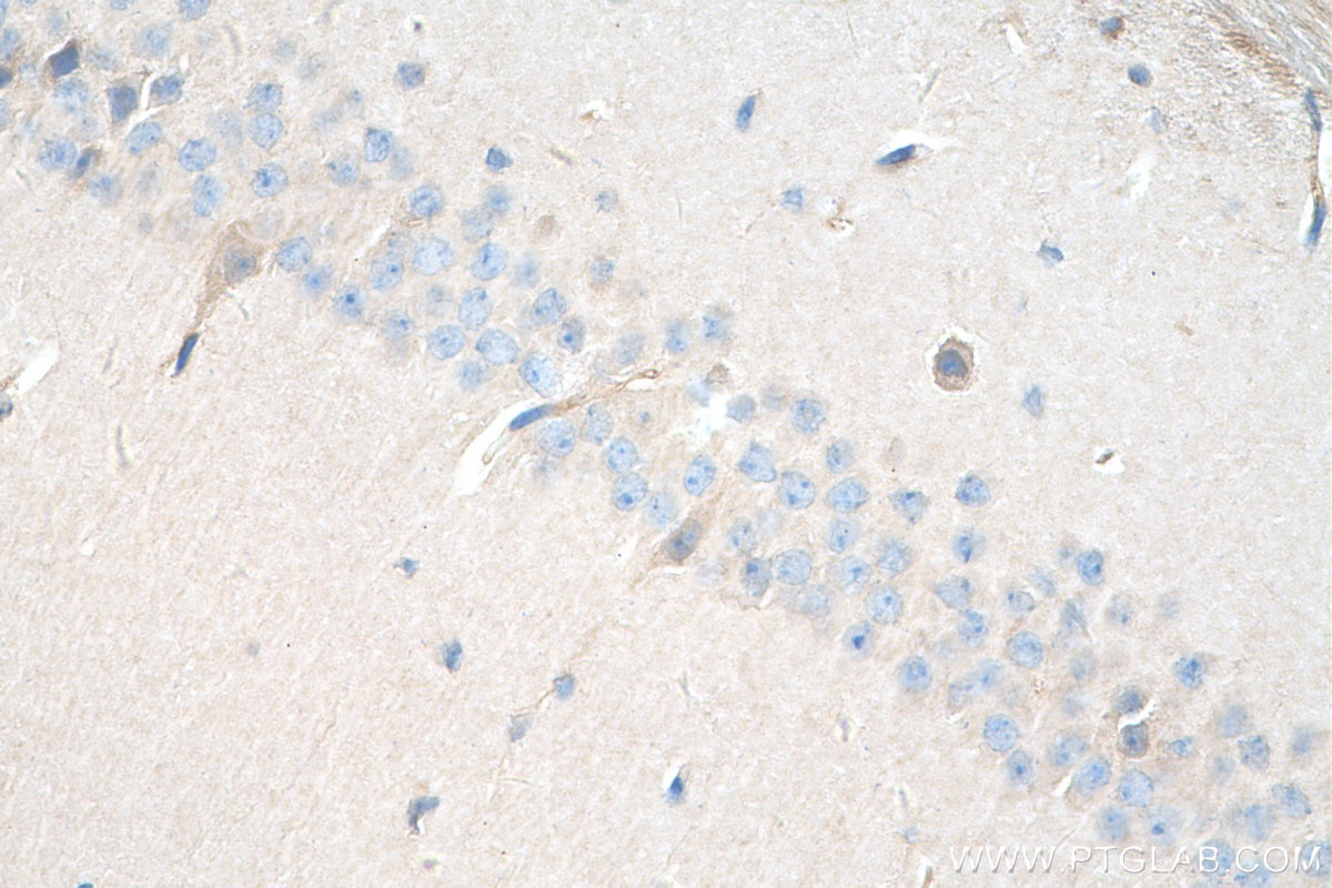 Immunohistochemistry (IHC) staining of mouse brain tissue using CYTSA Polyclonal antibody (25390-1-AP)