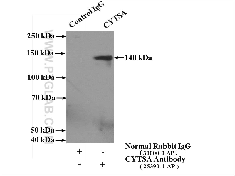Immunoprecipitation (IP) experiment of mouse brain tissue using CYTSA Polyclonal antibody (25390-1-AP)