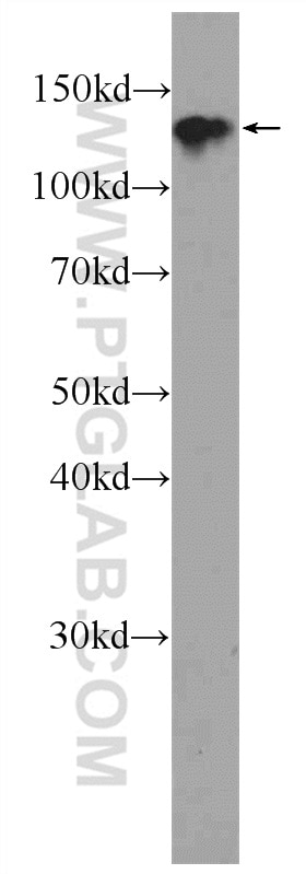 Western Blot (WB) analysis of NIH/3T3 cells using CYTSA Polyclonal antibody (25390-1-AP)