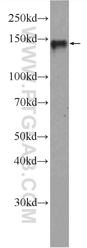 Western Blot (WB) analysis of HeLa cells using CYTSA Polyclonal antibody (25390-1-AP)