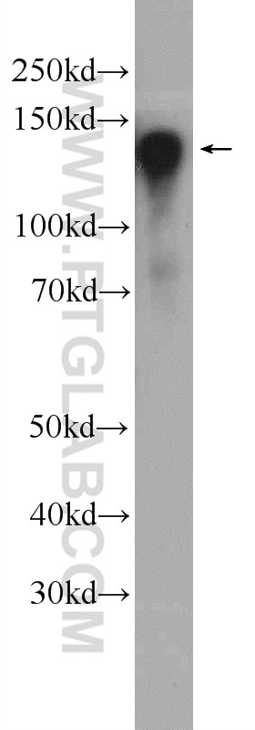 Western Blot (WB) analysis of mouse brain tissue using CYTSA Polyclonal antibody (25390-1-AP)