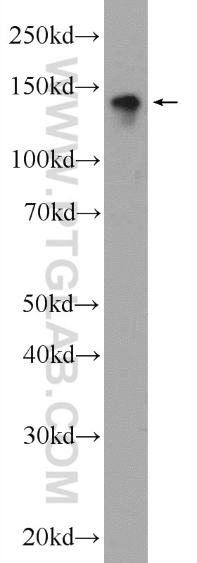 Western Blot (WB) analysis of Neuro-2a cells using CYTSA Polyclonal antibody (25390-1-AP)