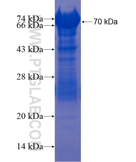 CYTSA fusion protein Ag21896 SDS-PAGE