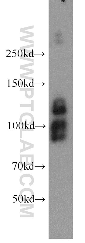 Western Blot (WB) analysis of HeLa cells using CYTSB Polyclonal antibody (13851-1-AP)