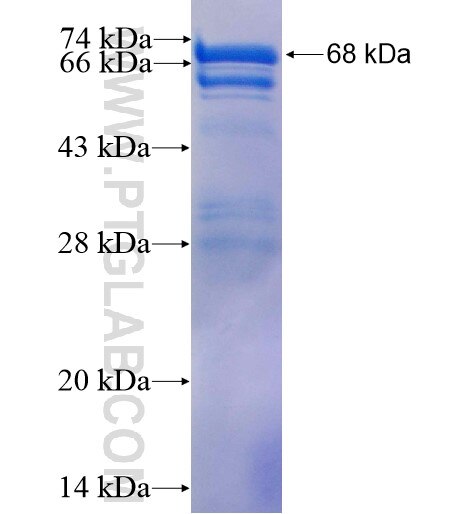 CYTSB fusion protein Ag4822 SDS-PAGE
